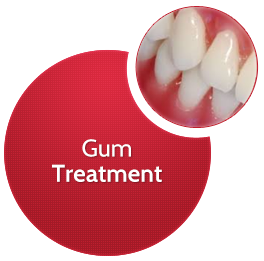 Gum Treatment